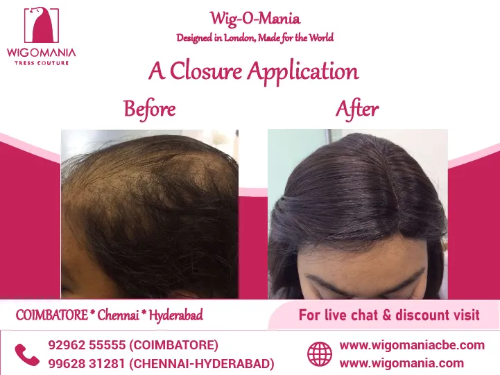 Ladies toupee for bald patches